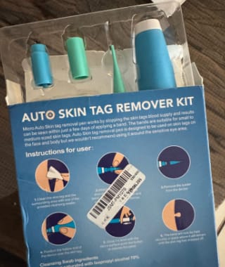 Customer photo review of Removedor de verrugas sin dolor