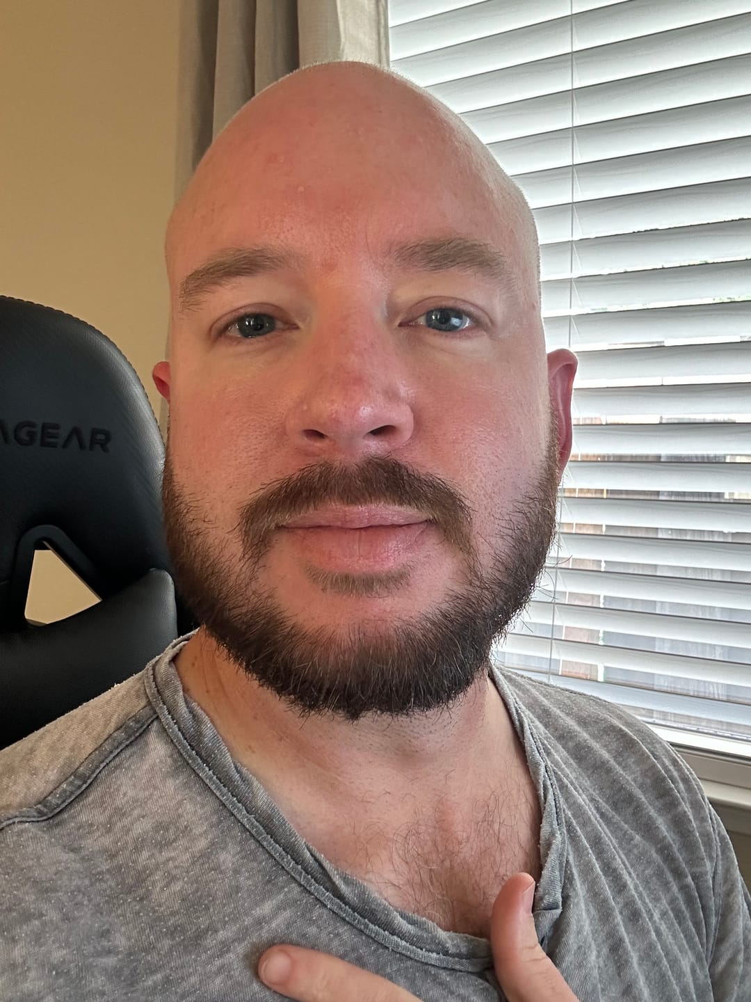 Customer photo review of 5 Piece Beard Oil Sample Pack | 2.5 oz