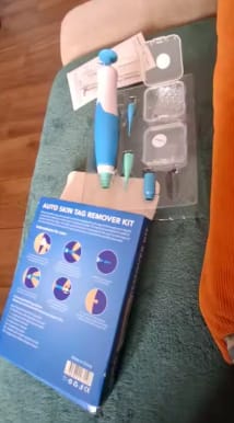 Customer photo review of Removedor de verrugas sin dolor
