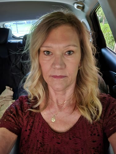 Reviewer showing skin results after using the Seranova Micro Infusion System