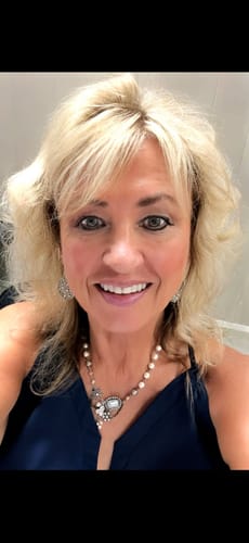 Customer's smiling face after using the Seranova Micro Infusion System for monthly skincare treatments.