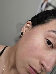 Customer photo review of VitaRadiance™ Face Serum