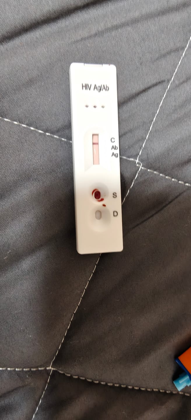 Customer photo review of STD自宅検査｜HIV(エイズ) 検査キット