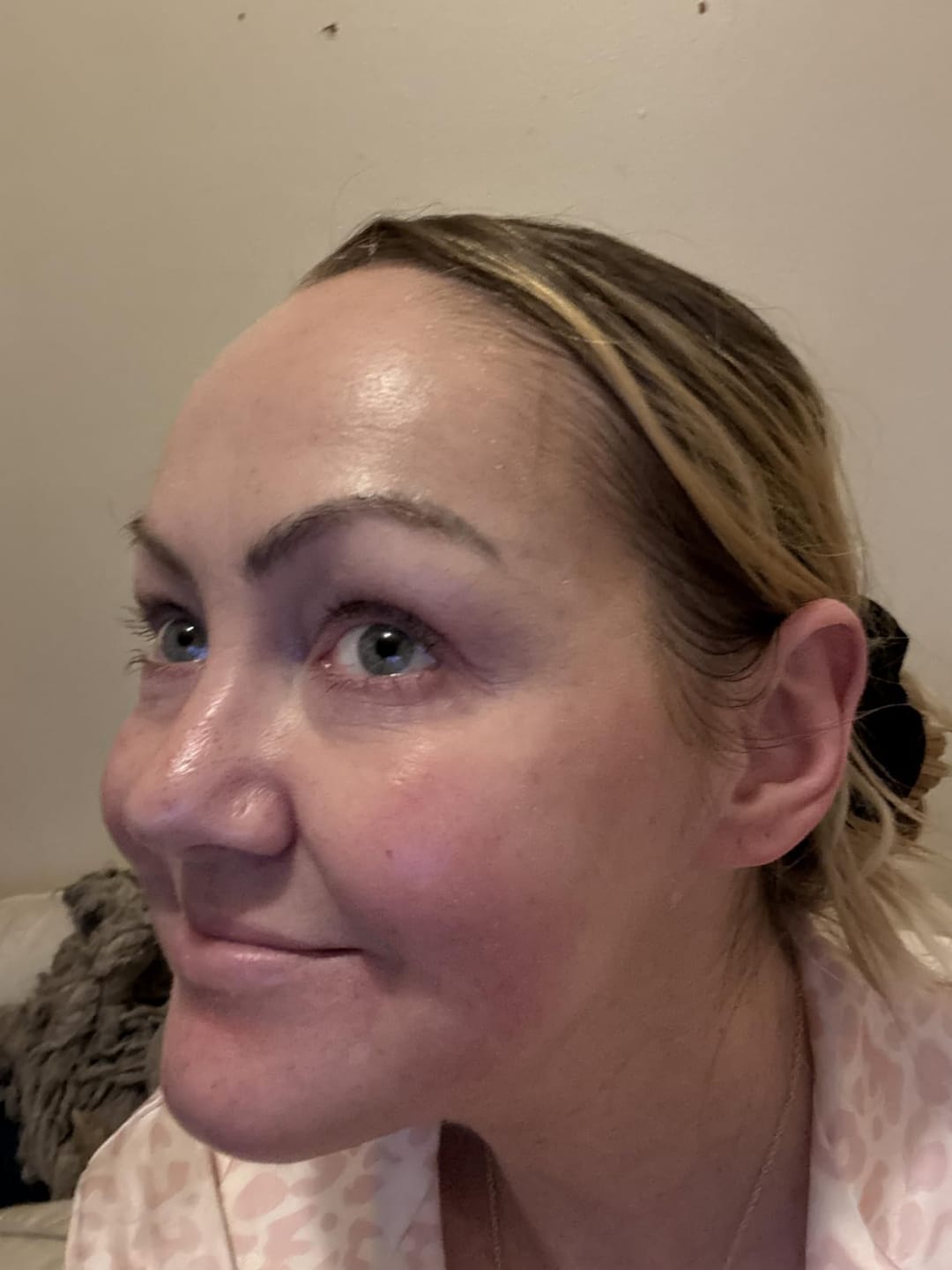 Customer photo review of CollaBloom™ Hydrating Lotion