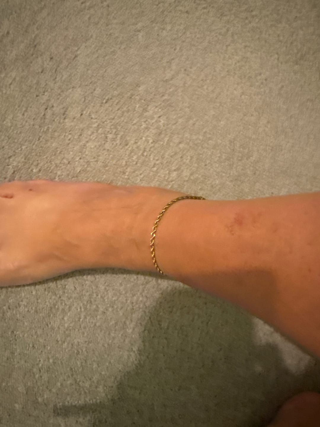 Customer photo review of Bold Rope Anklet