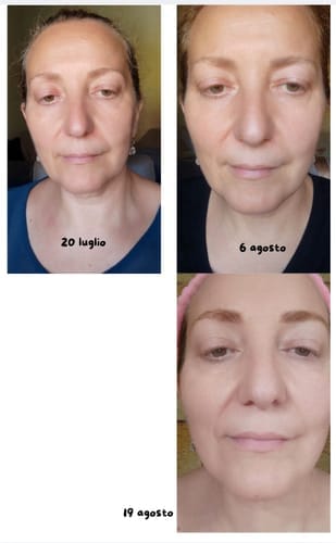 Customer photo review of BioChroma – Koreanisches Lifting-Serum mit sichtbarem Effekt ab der ersten Anwendung