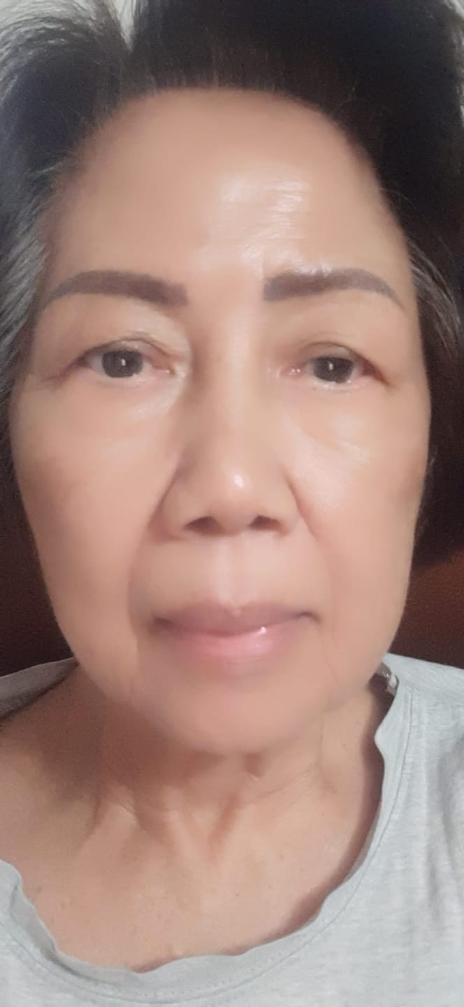 Customer photo review of Sea Cucumber Collagen Instant Lift Eye Serum