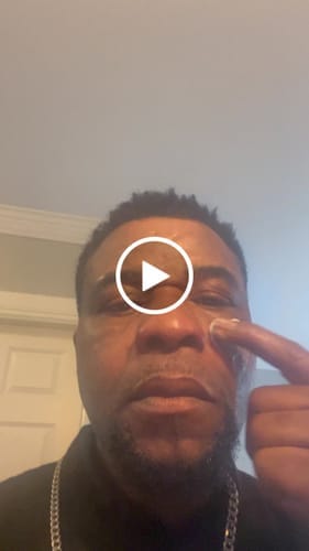 Customer photo review of Wrinkle Defense Tallow Balm