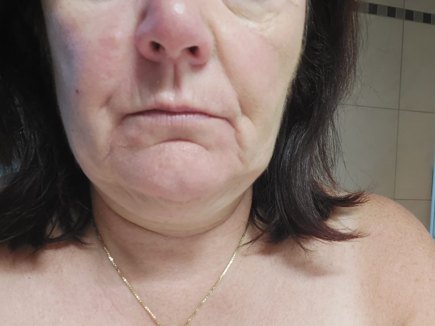 Customer photo review of Rosalique 3 in 1 Anti-Redness Miracle Formula SPF50