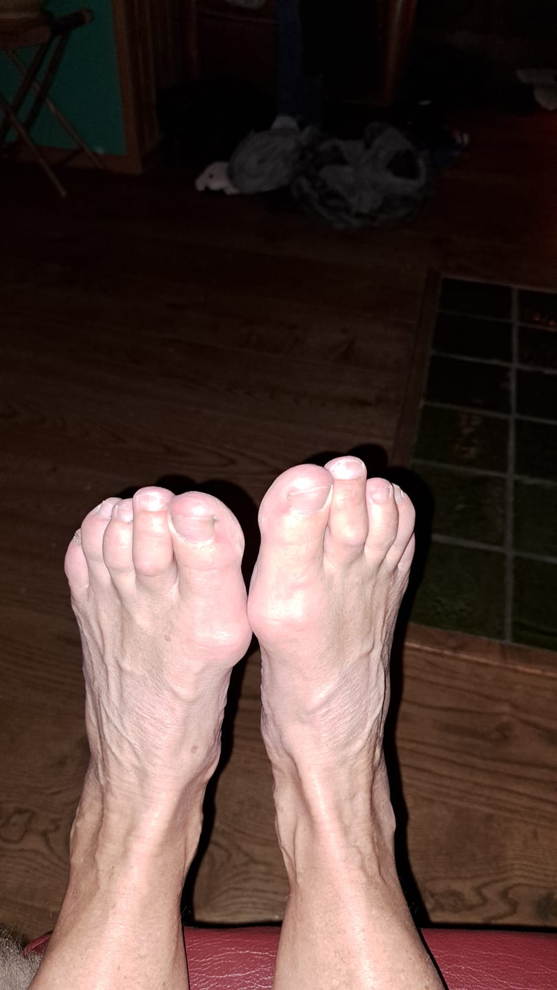 Customer photo review of Foamr® - Massage inlegzolen