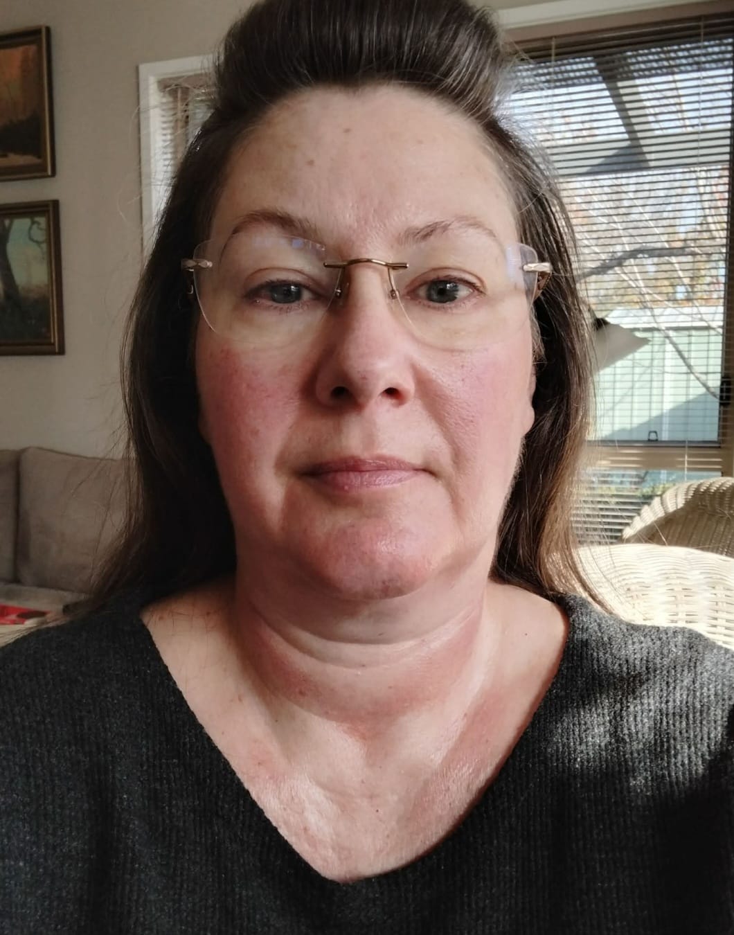 Customer photo review of Neck Firming Cream
