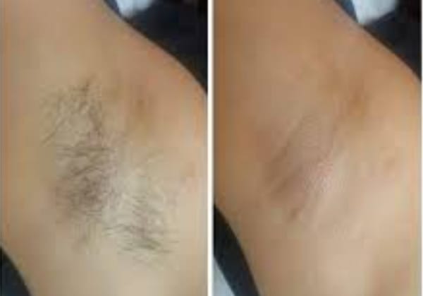 Customer photo review of Cyperus Rotundus Oil