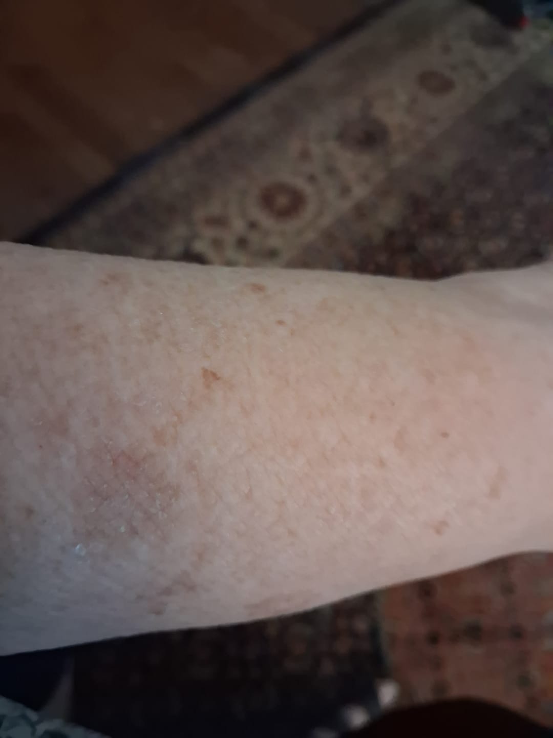 Customer photo review of Botanical Body Oil™