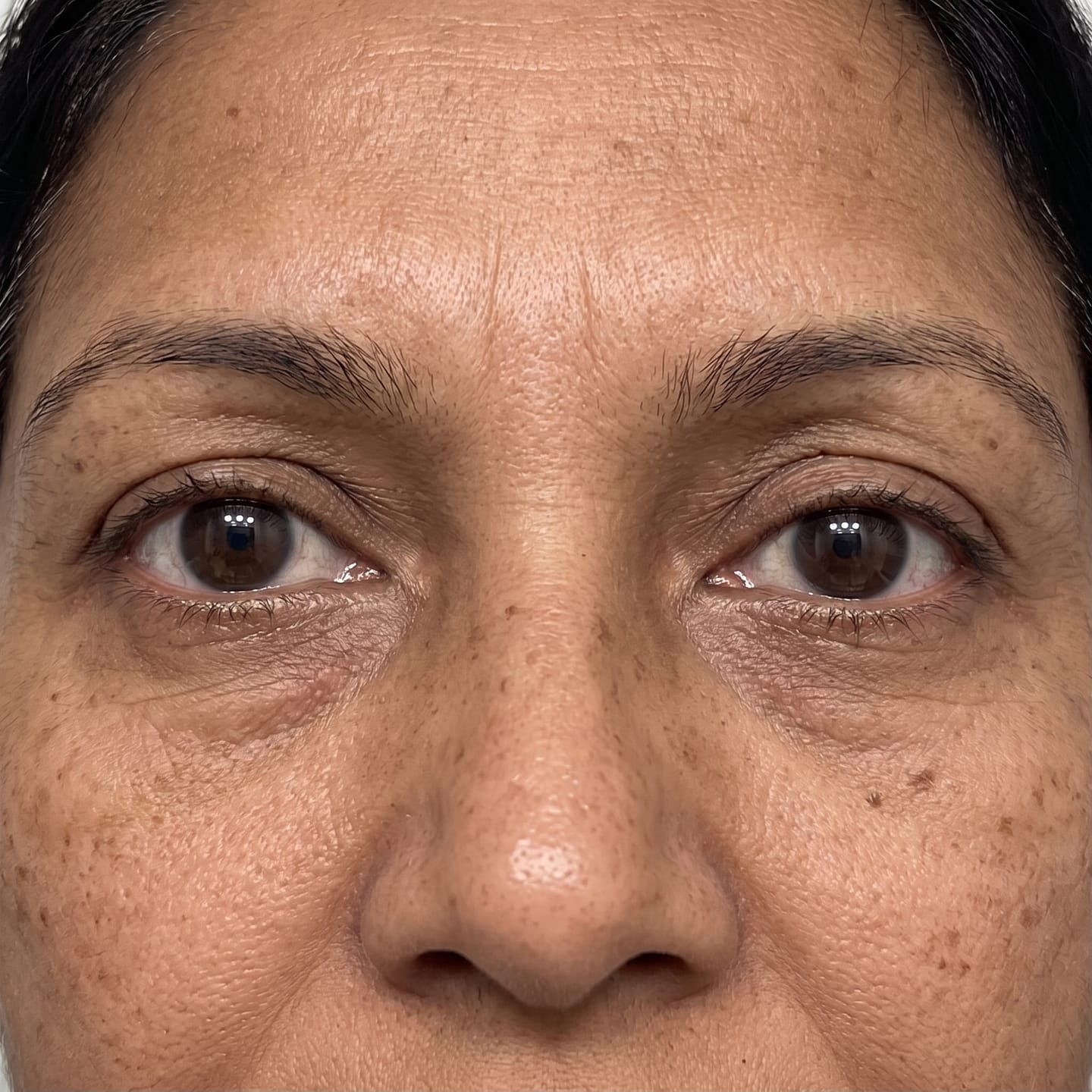 Customer photo review of Concele™ Rapid Eye Firmer