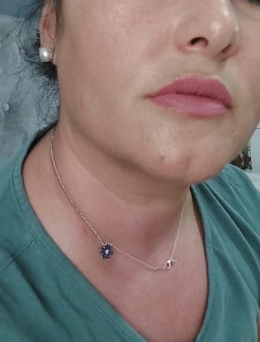 Customer photo review of BioChroma – Koreanisches Lifting-Serum mit sichtbarem Effekt ab der ersten Anwendung
