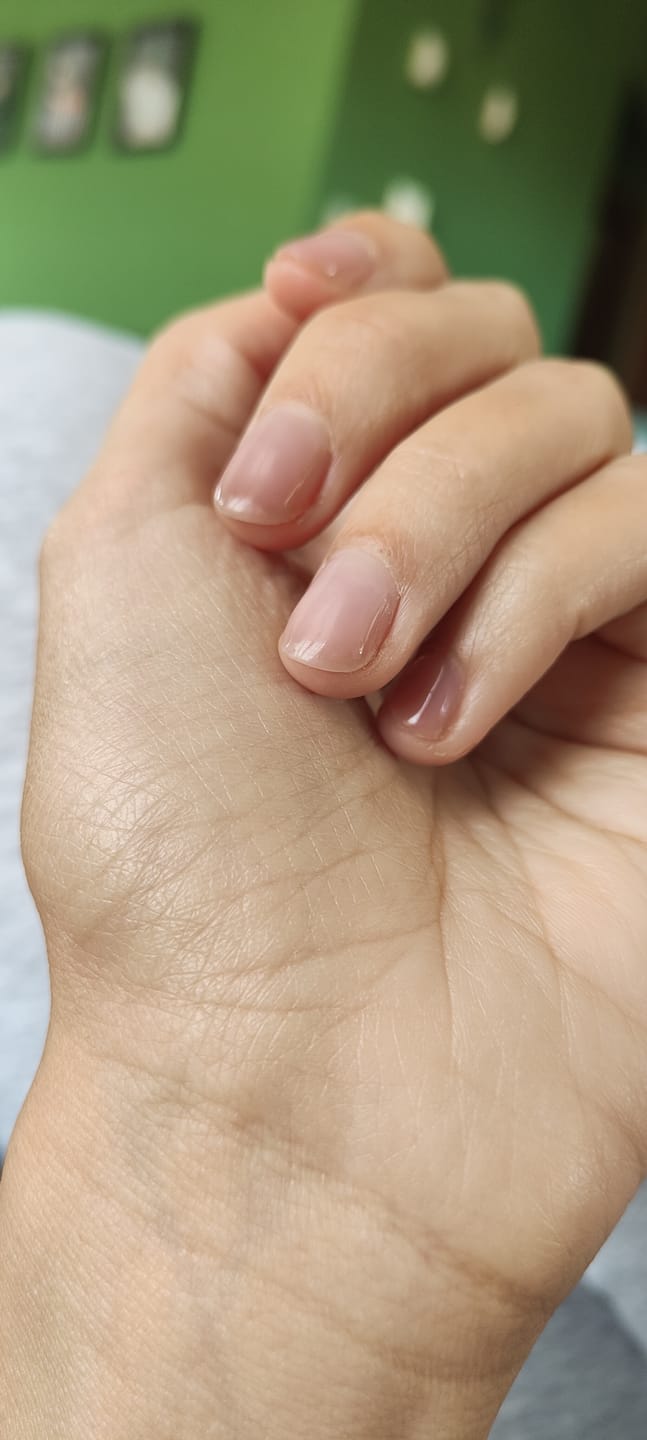 Customer photo review of Restructura Base&Go 05 - Rubber Base Hema Free - 15 ml  LCI