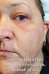 Customer photo review of CollaBloom™ Hydrating Lotion