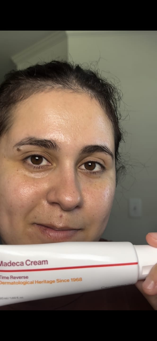 Customer photo review of Madeca Cream Time Reverse 50ml