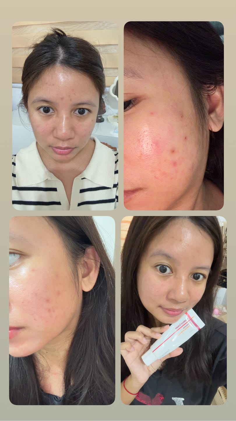 Customer photo review of Madeca Cream Time Reverse 50ml