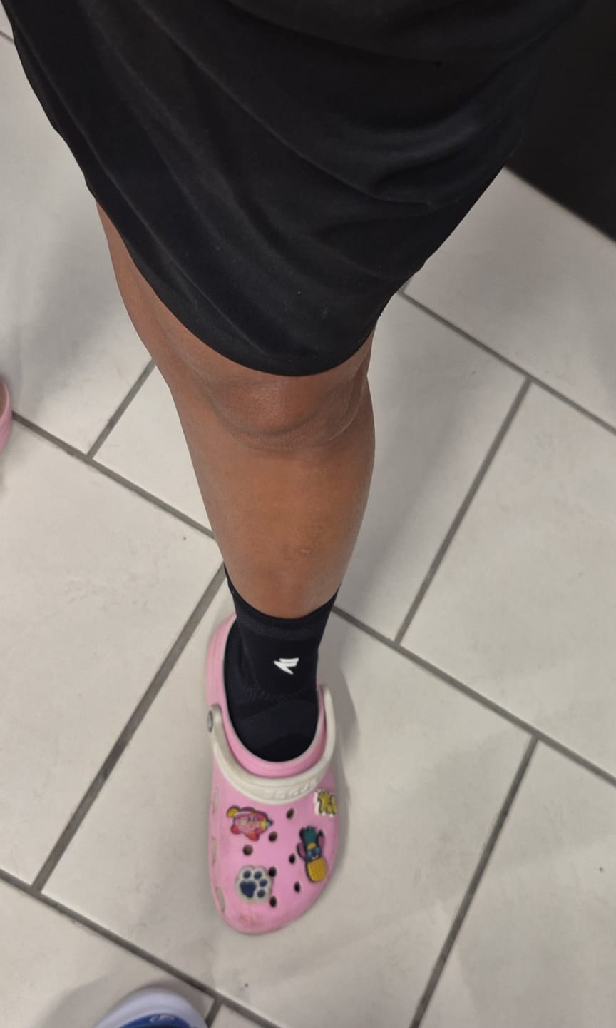 Customer photo review of Maintien de Compression pour Chevilles V3