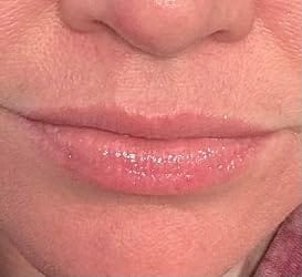 Customer photo review of GlassKiss™ Glossy Lip Balm