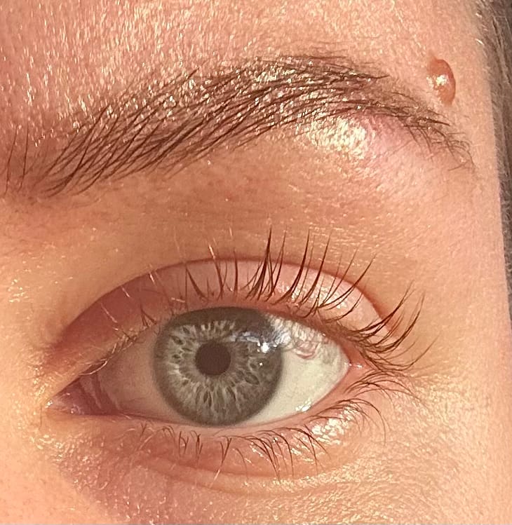 Customer photo review of SimplyLash kit