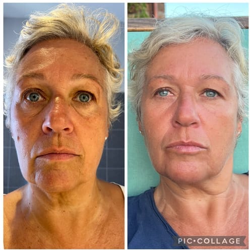 Customer photo review of BioChroma – Koreanisches Lifting-Serum mit sichtbarem Effekt ab der ersten Anwendung