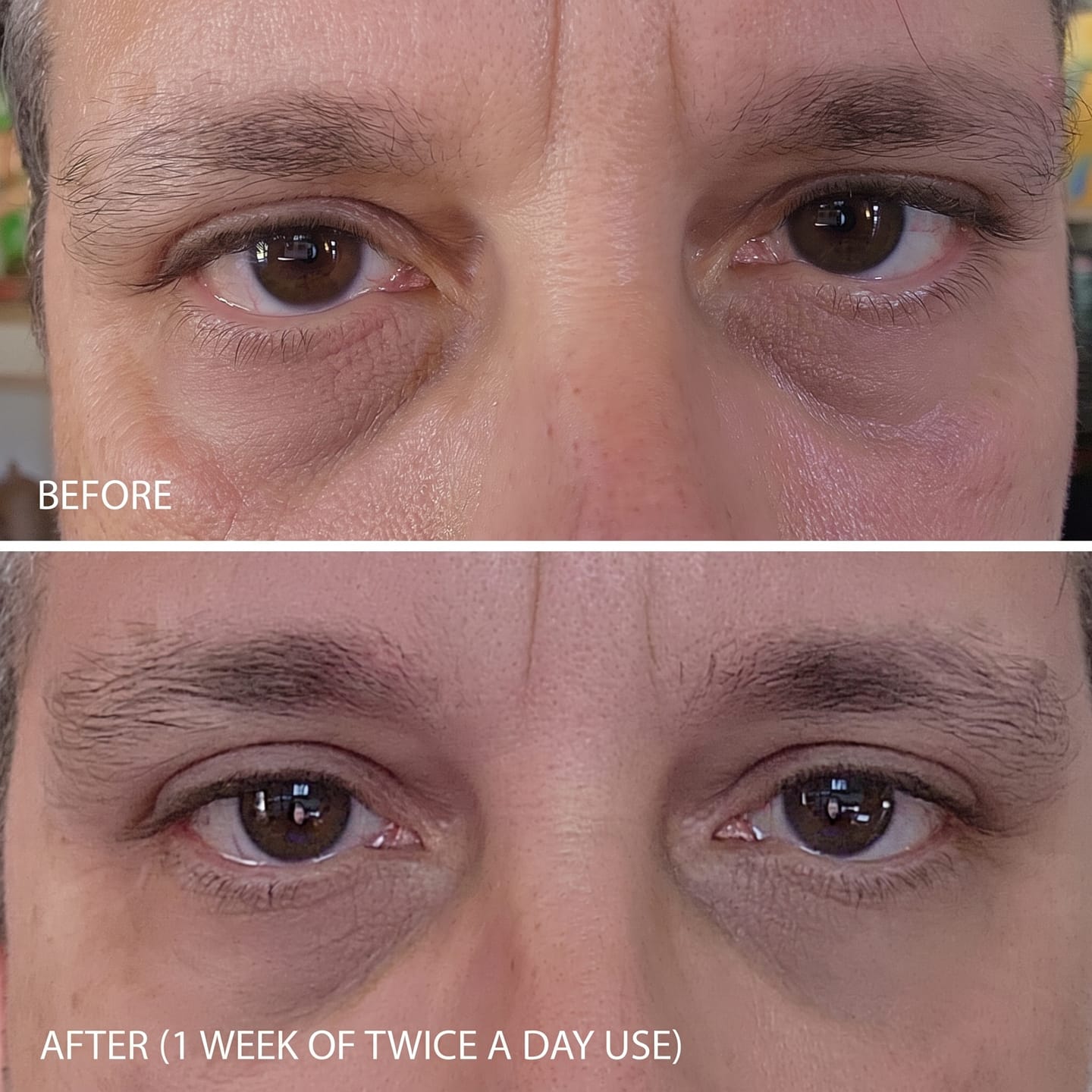 Customer photo review of Concele™ Rapid Eye Firmer
