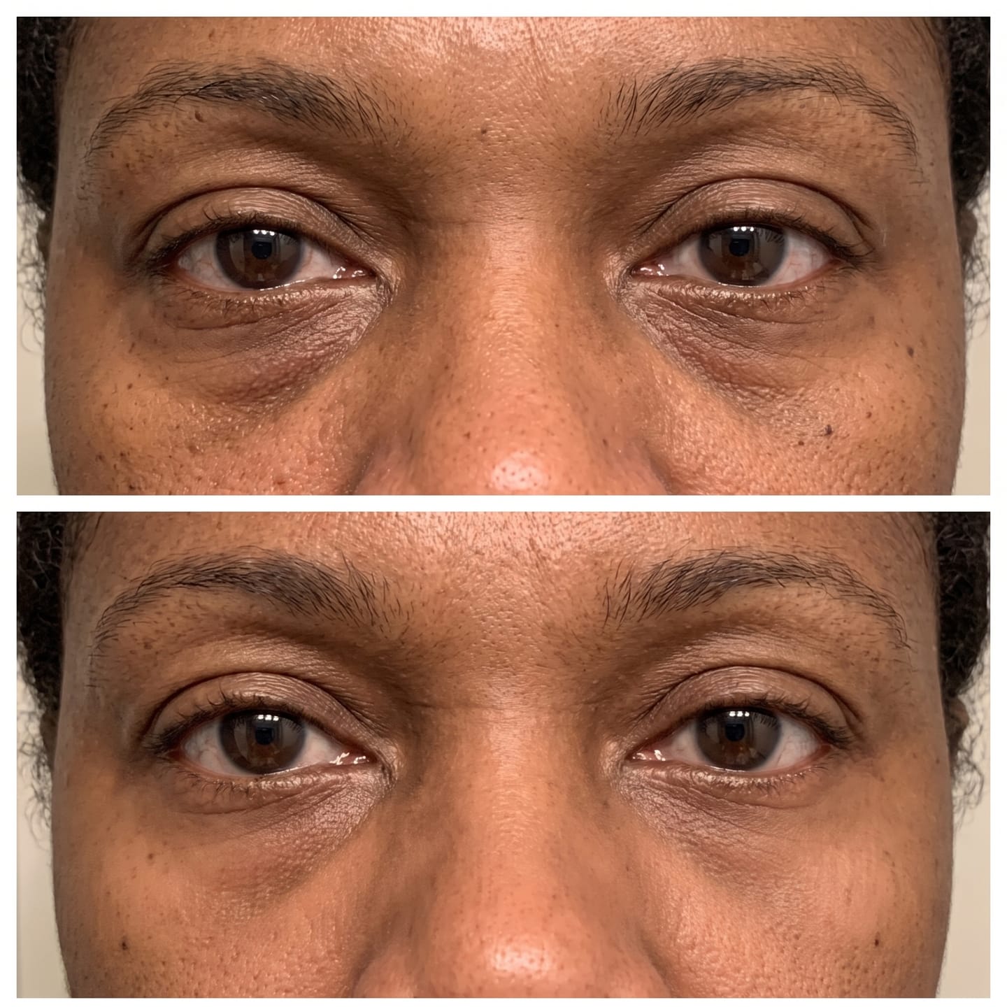 Customer photo review of Concele™ Rapid Eye Firmer