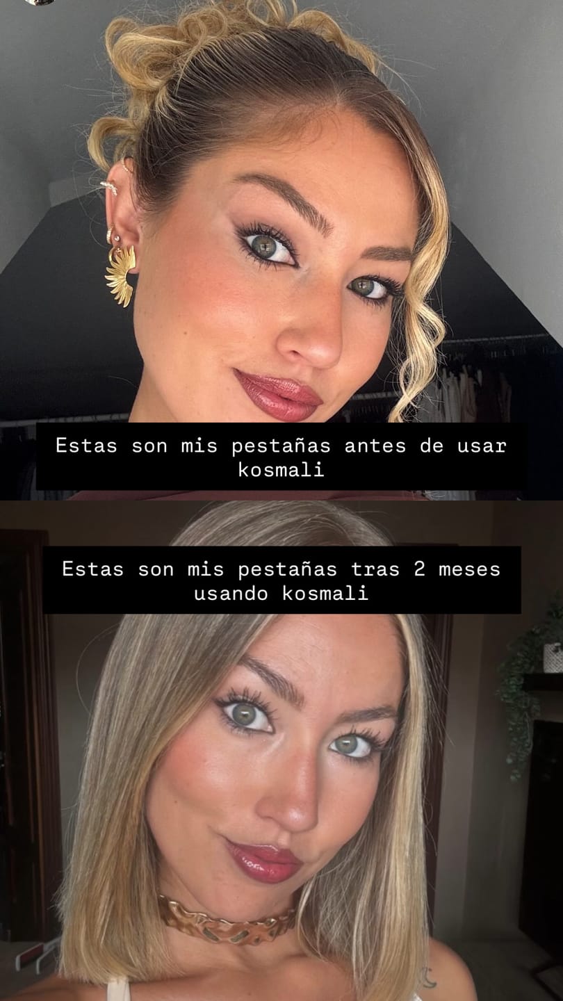 Customer photo review of KosmaLash® | Sérum Crecimiento & Anticaída