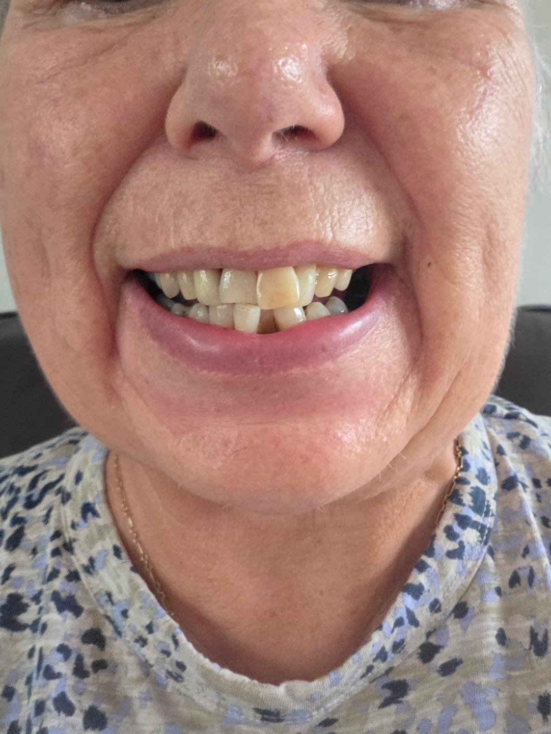 Customer photo review of Oral Care Essentials Bundle