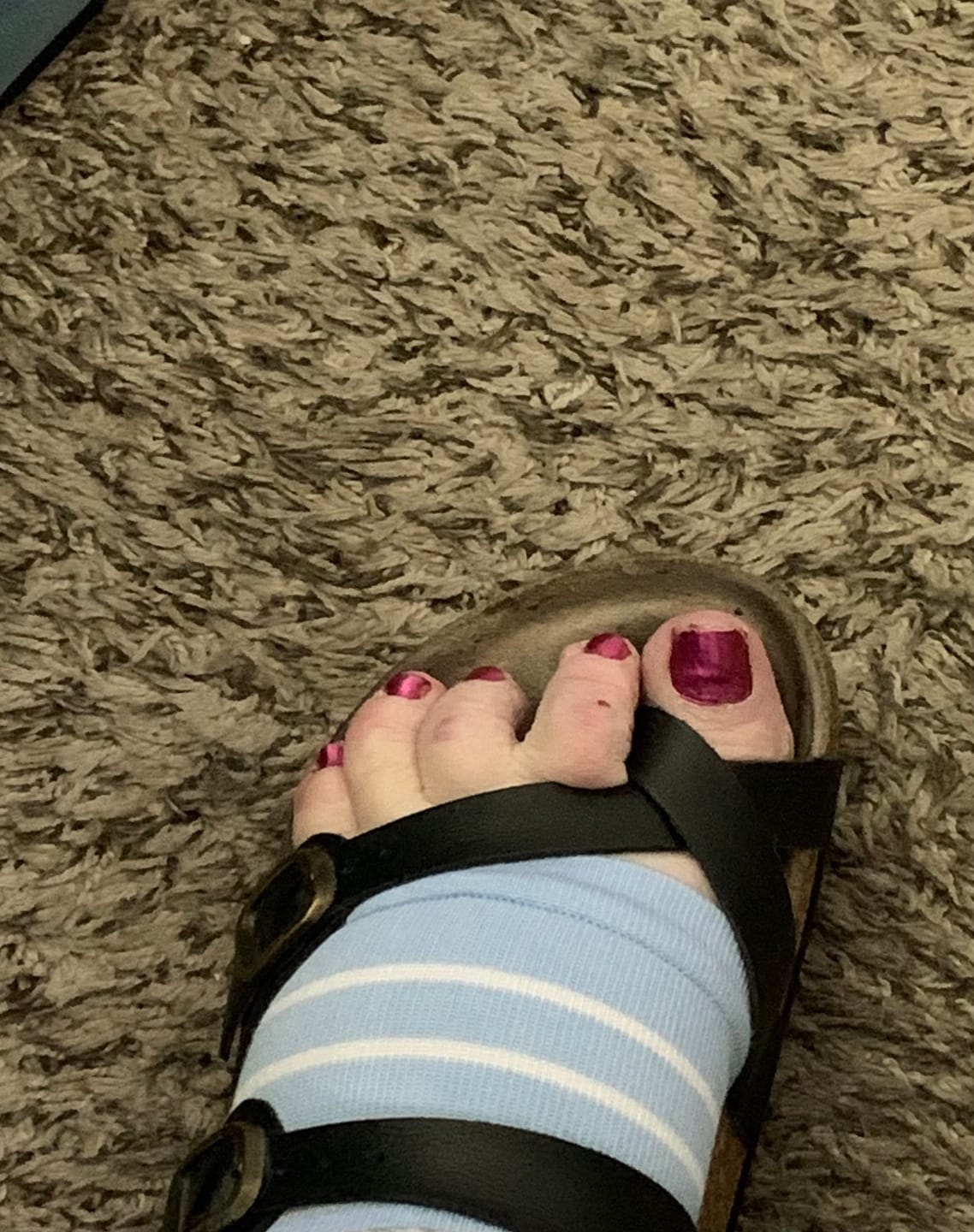 Customer photo review of EverSock™ Bamboo Open Toe Compression Socks