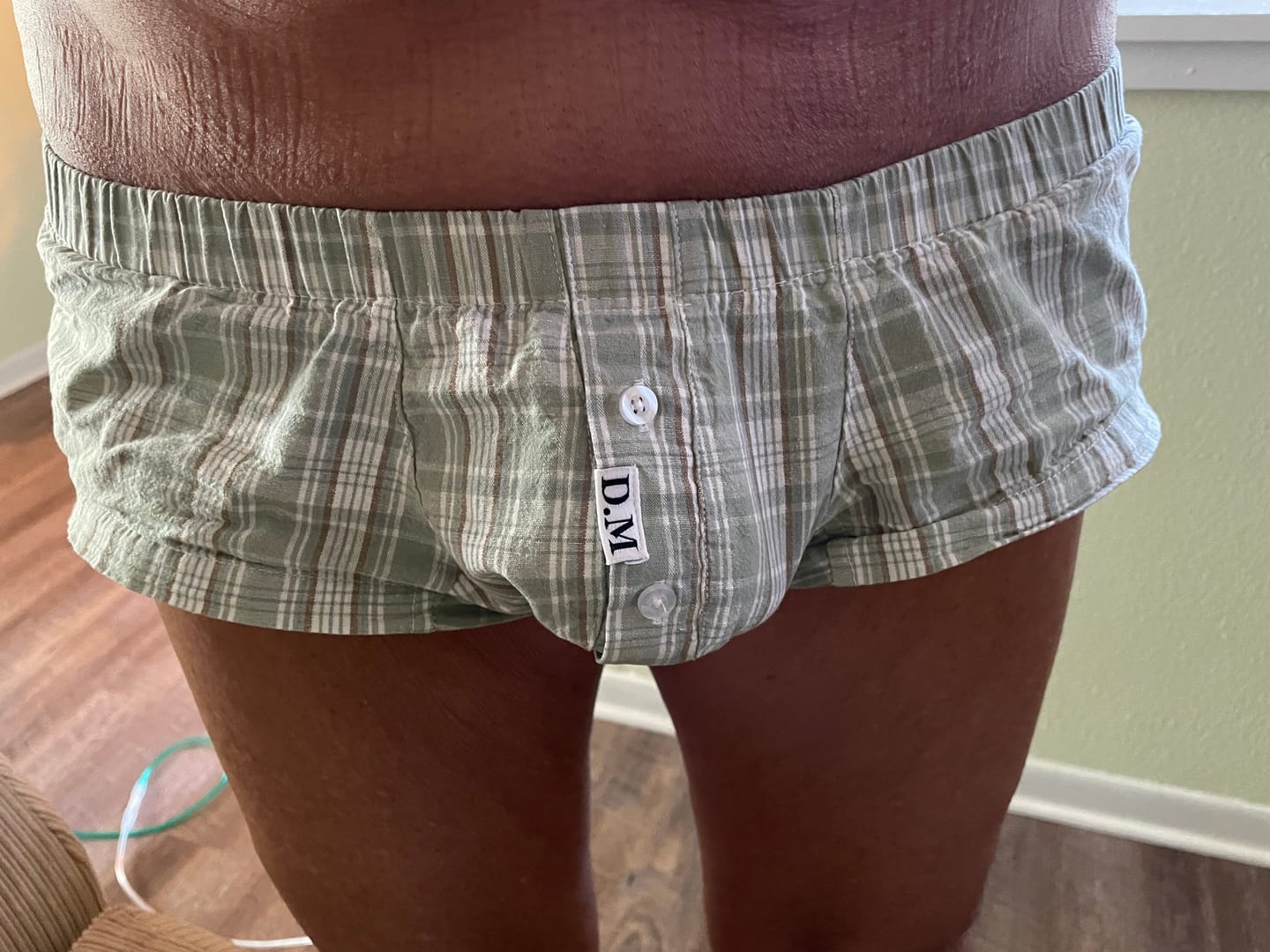 Customer photo review of 3 Pack Men’s Plaid Cotton Trunks with Button Fly