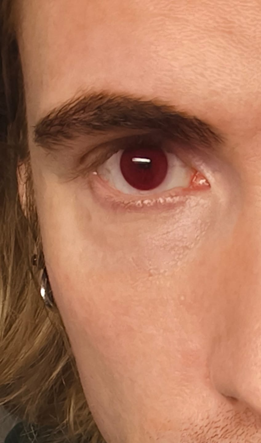Customer photo review of Eyeling Red