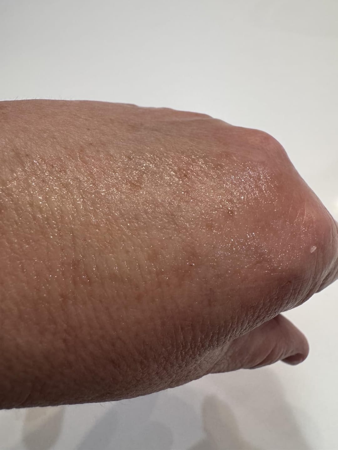 Customer photo review of Wrinkle Bounce Multi Balm ℗