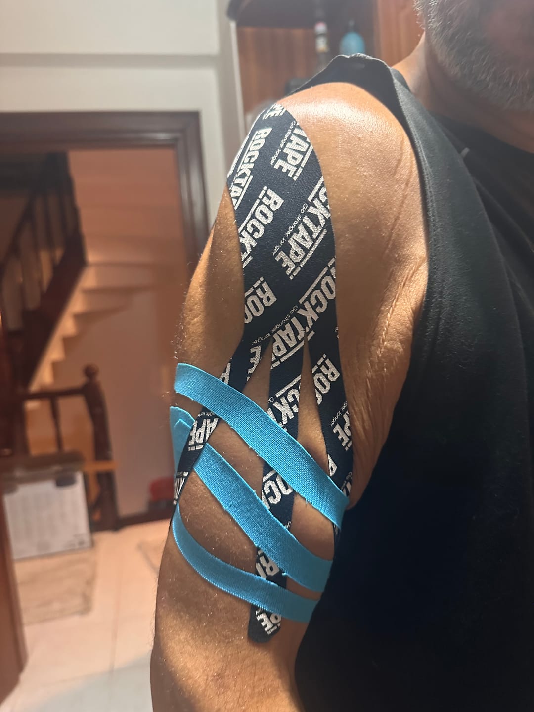 Customer photo review of Ekstra Yapışkan Kinezyoloji Bant | Siyah Logo | 5cm x 5m