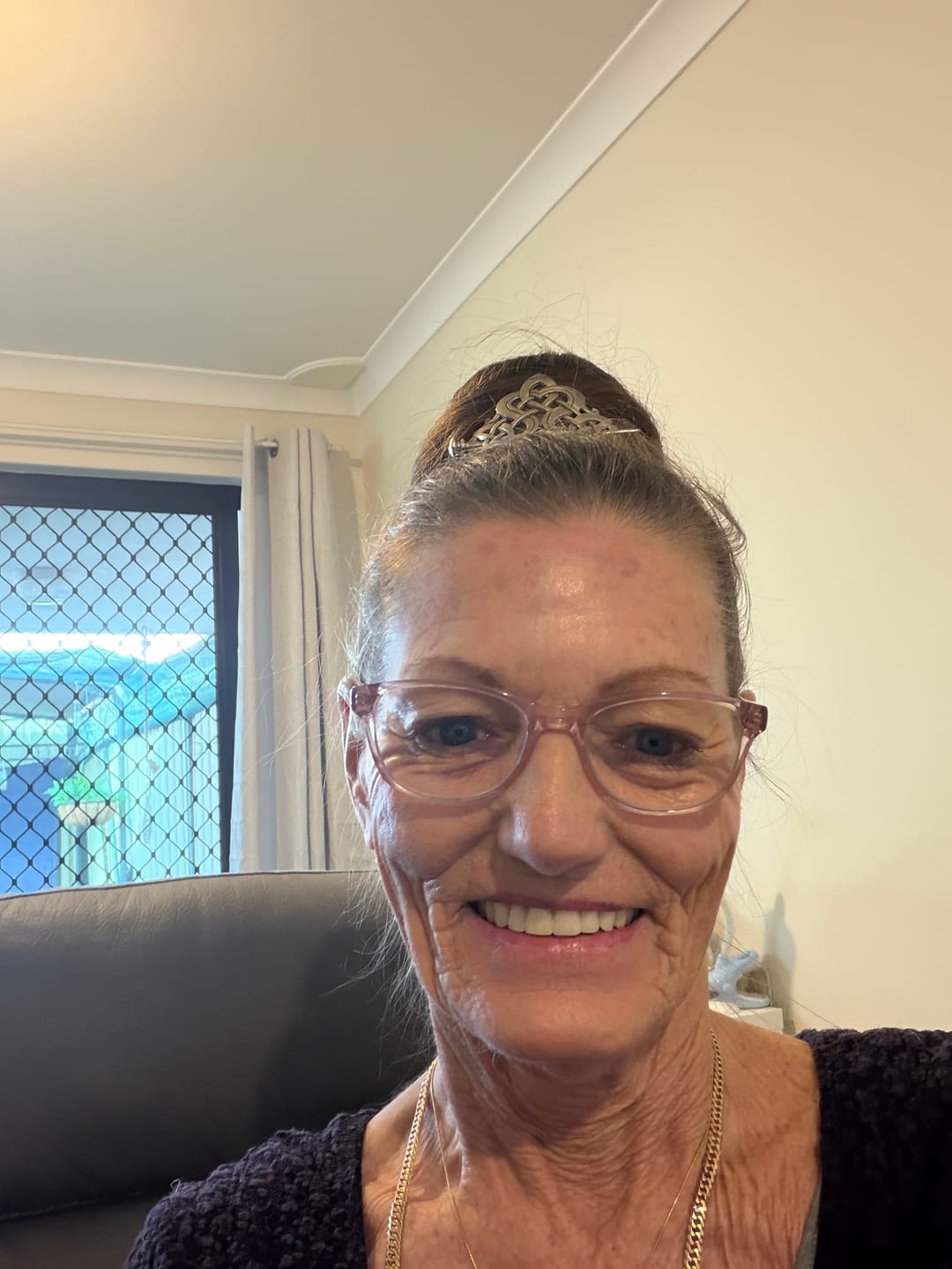 Customer photo review of New! Bakuchiol Aloe Advanced Restore Cream