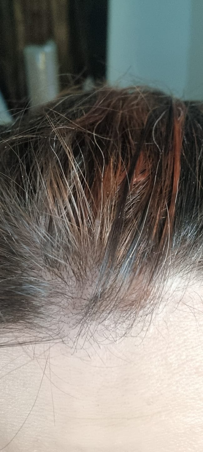 Customer photo review of Mattie Copper Orange - Vegan Semi-Permanent Direct Dye Hair Color Cream 210 ml