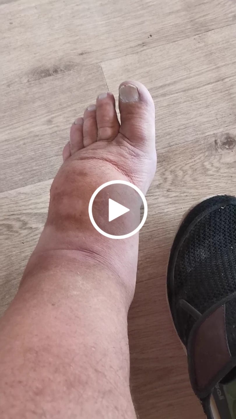 Customer video review of Chaussures Orthopédiques Larges & Confortables