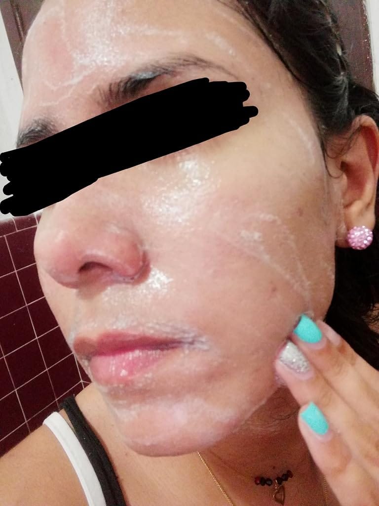 Customer photo review of Bioderma Sebium Purifying Cleansing Foaming Gel