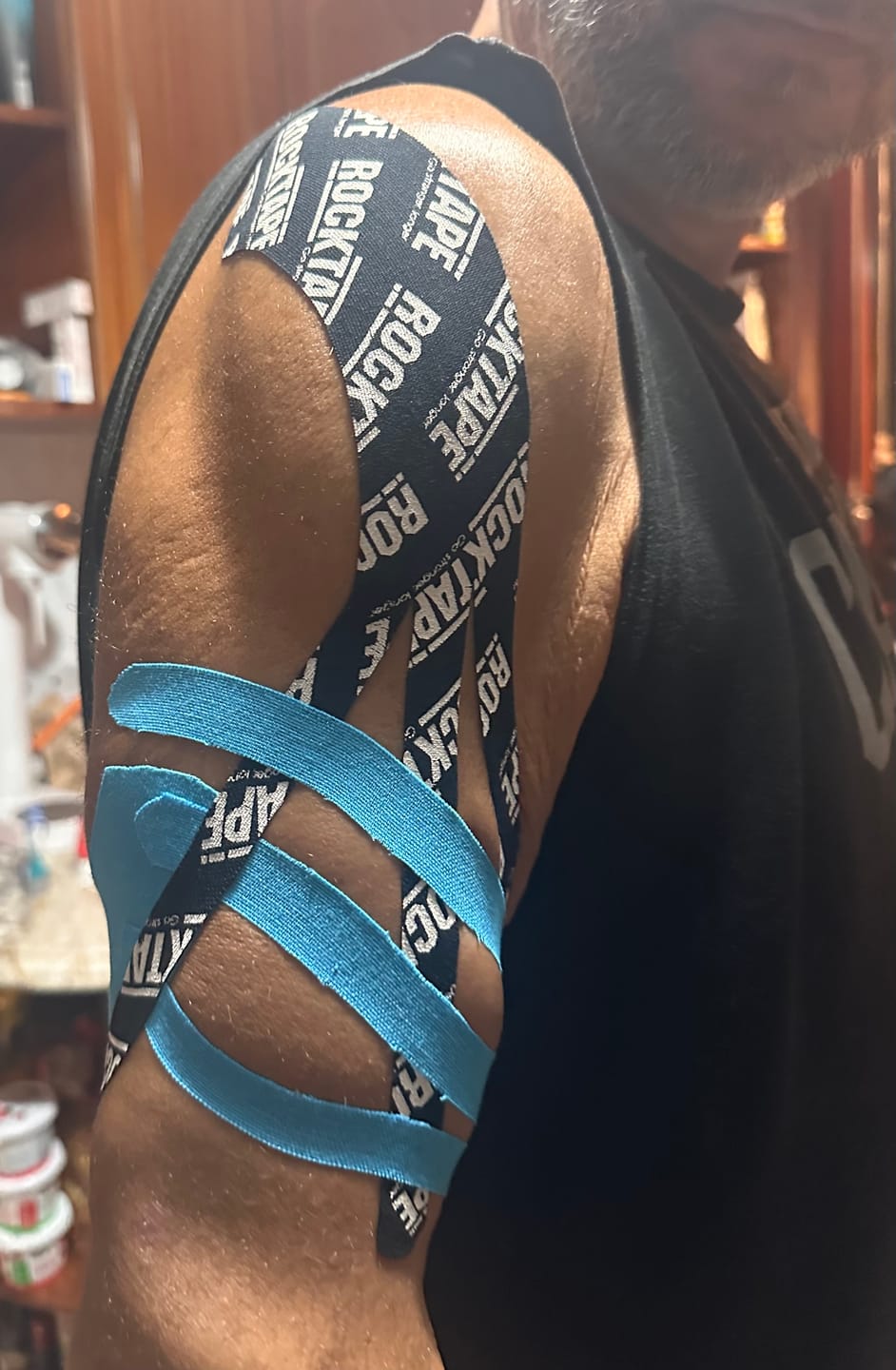 Customer photo review of Ekstra Yapışkan Kinezyoloji Bant | Mavi | 5cm x 5m
