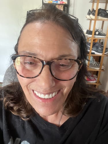 Customer's smiling face showing skin texture after using the Seranova Micro Infusion System.