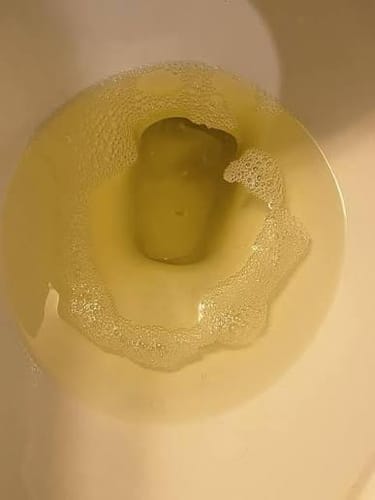 Customer photo review of Astaxantina - 12 mg