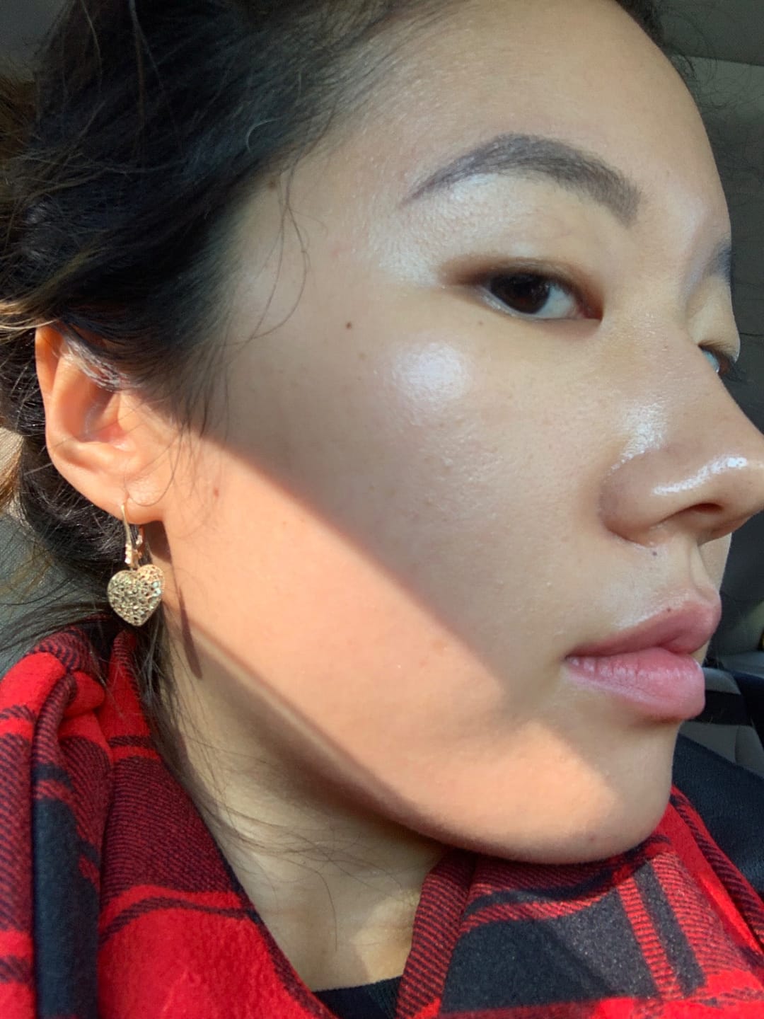 Customer photo review of 12-in-1 Perfect Skin Plasma Pen