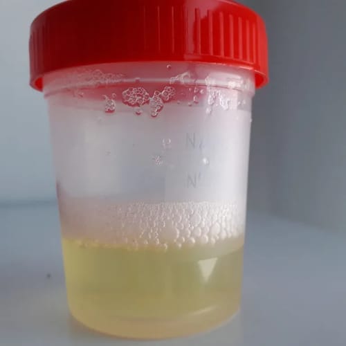 Customer photo review of Astaxantina - 12 mg