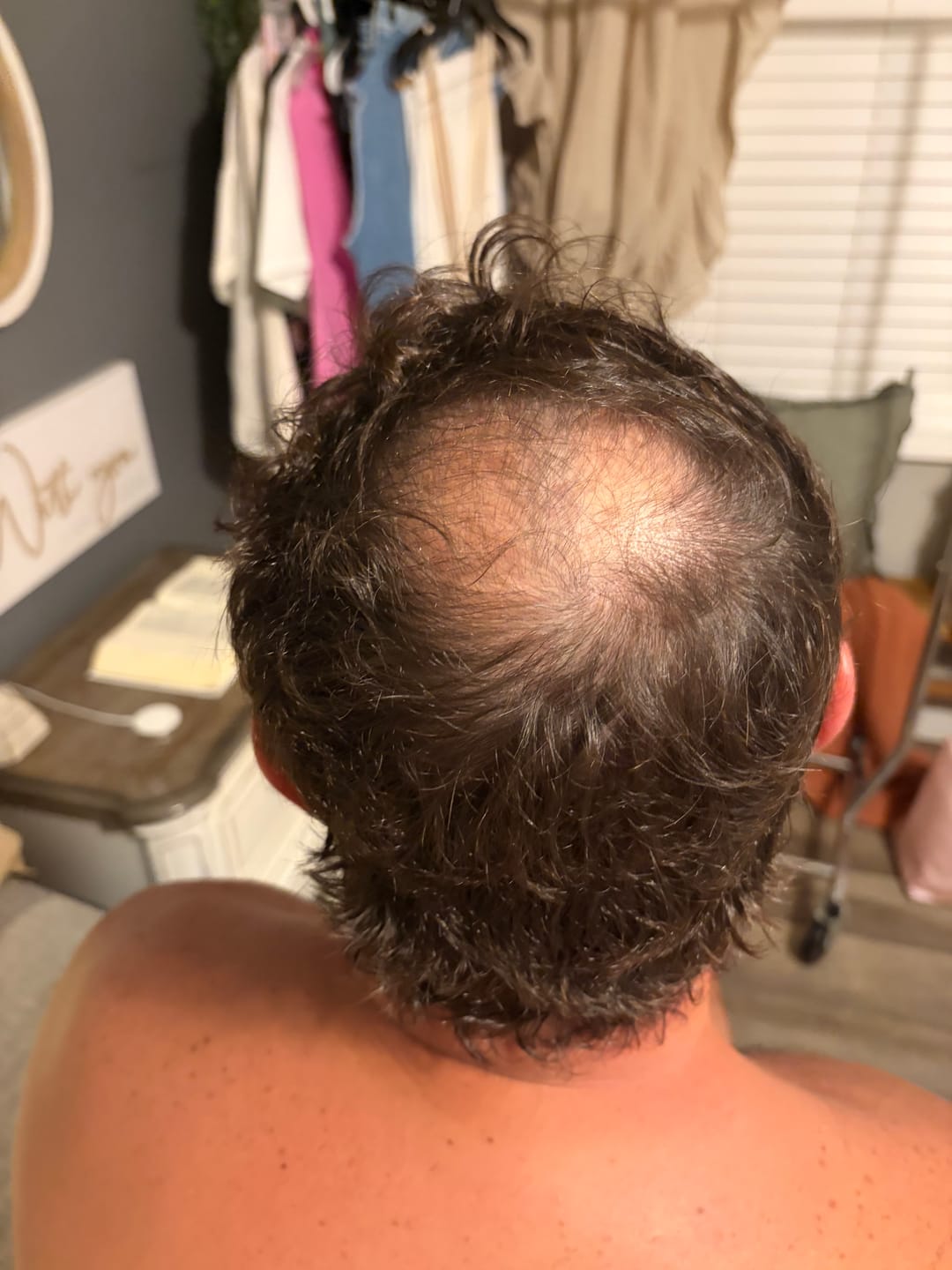 Customer photo review of Herbal Hair Growth Shampoo