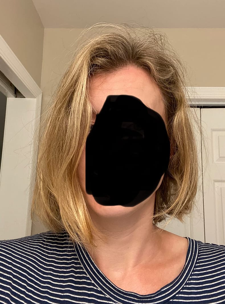 Customer photo review of Zilo™ Cabello perfecto en menos de 2 minutos.