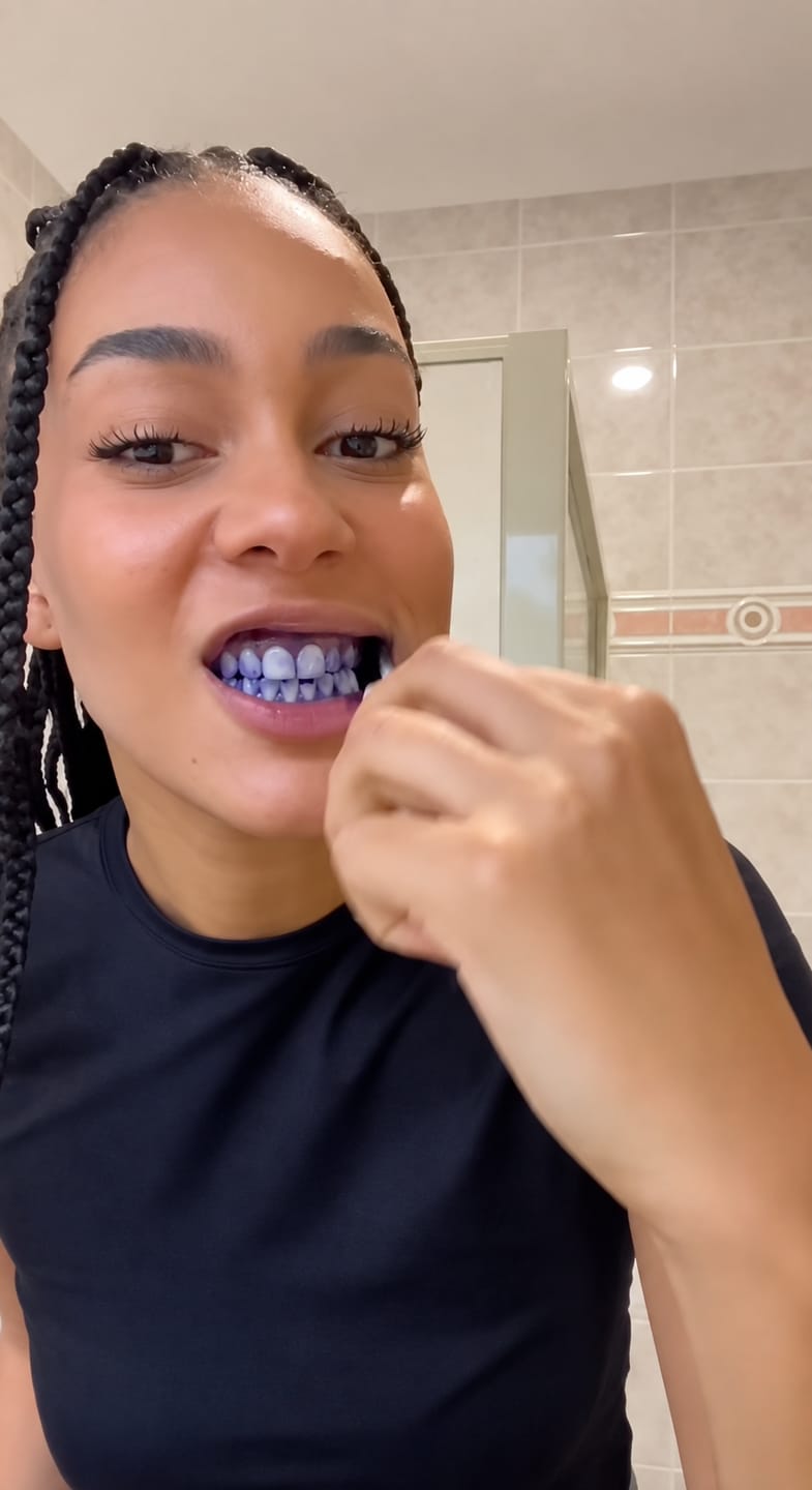 Customer photo review of CLUXO®—Blanqueador Dental V34