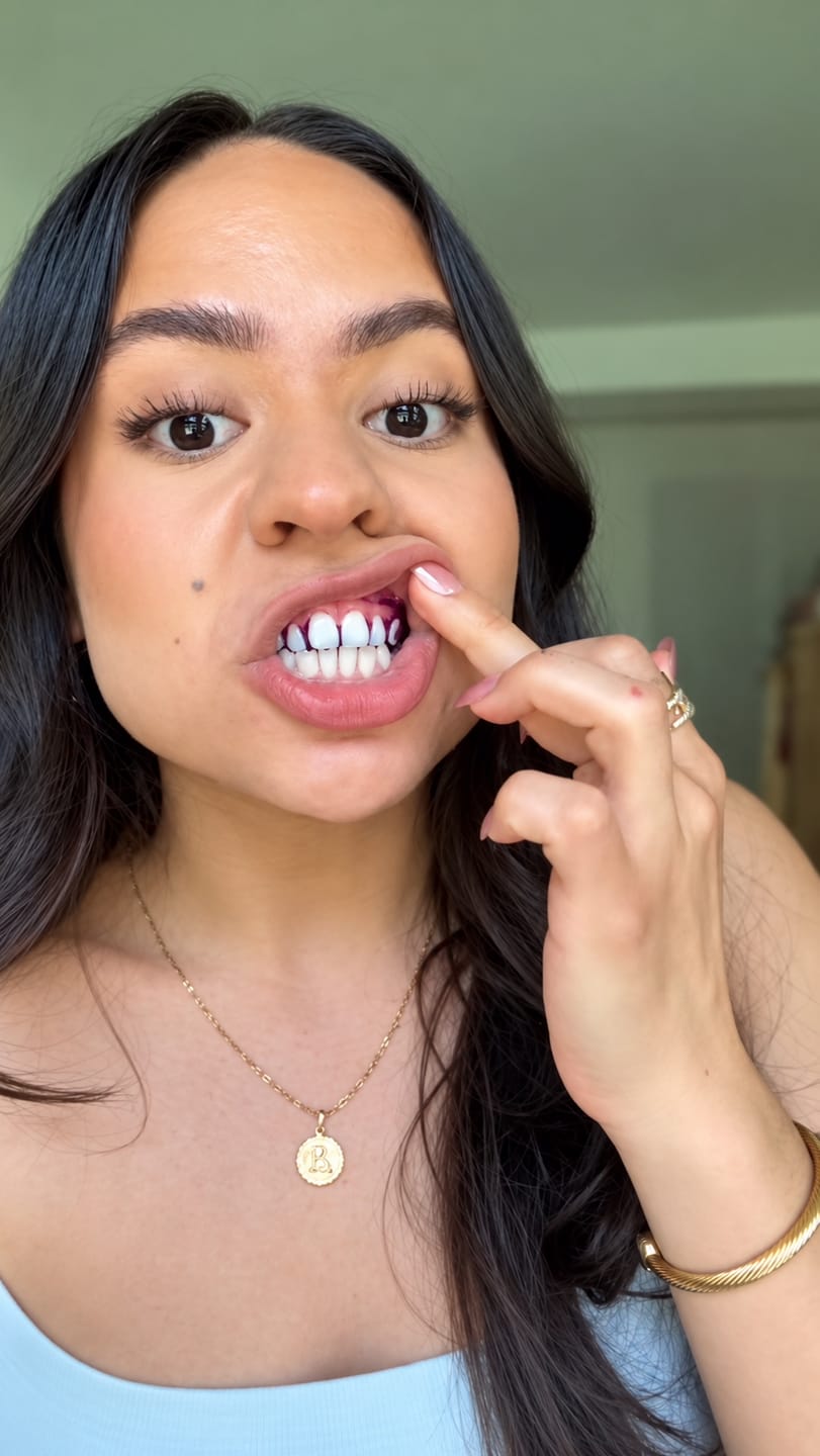 Customer photo review of CLUXO®—Blanqueador Dental V34
