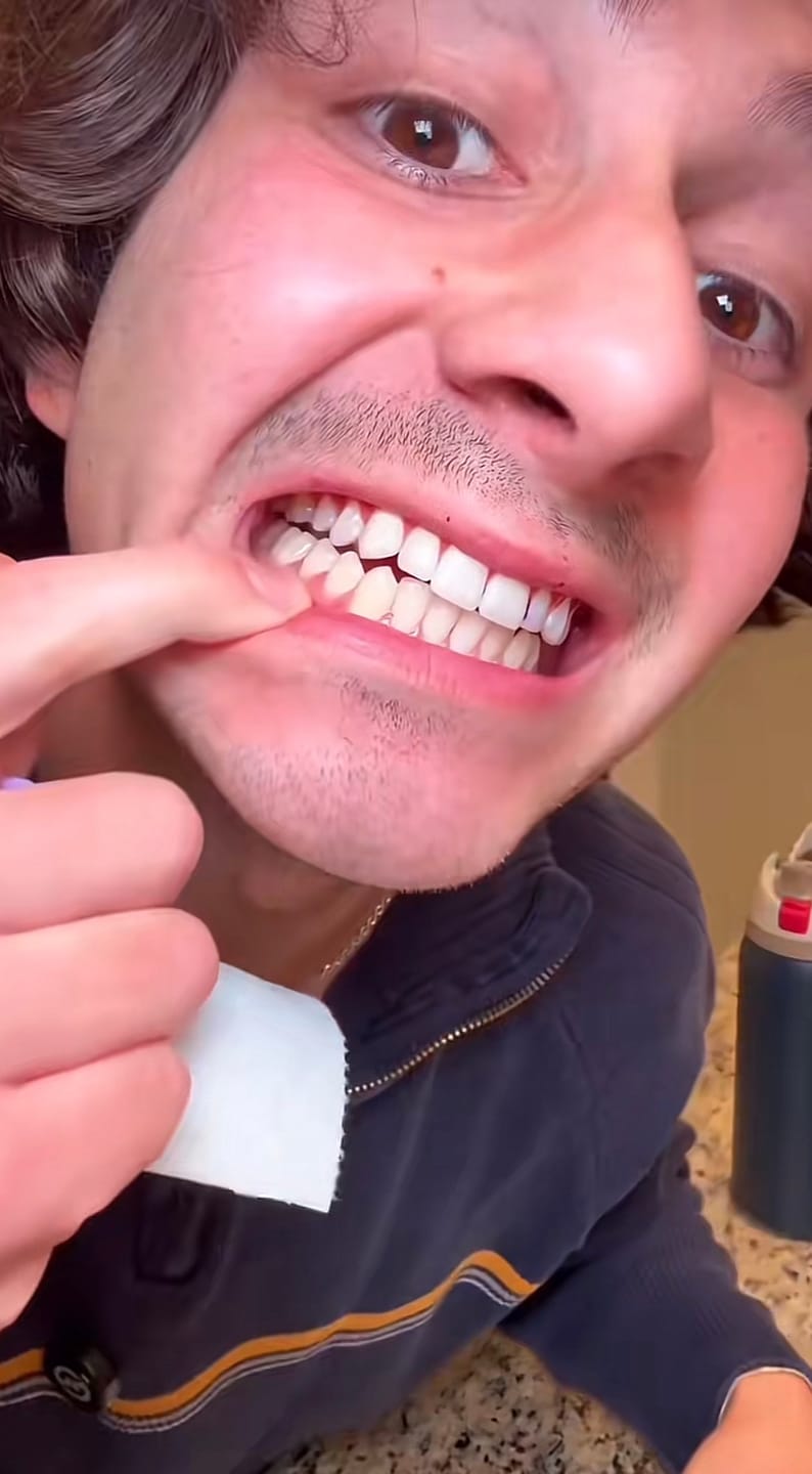 Customer photo review of CLUXO®—Blanqueador Dental V34